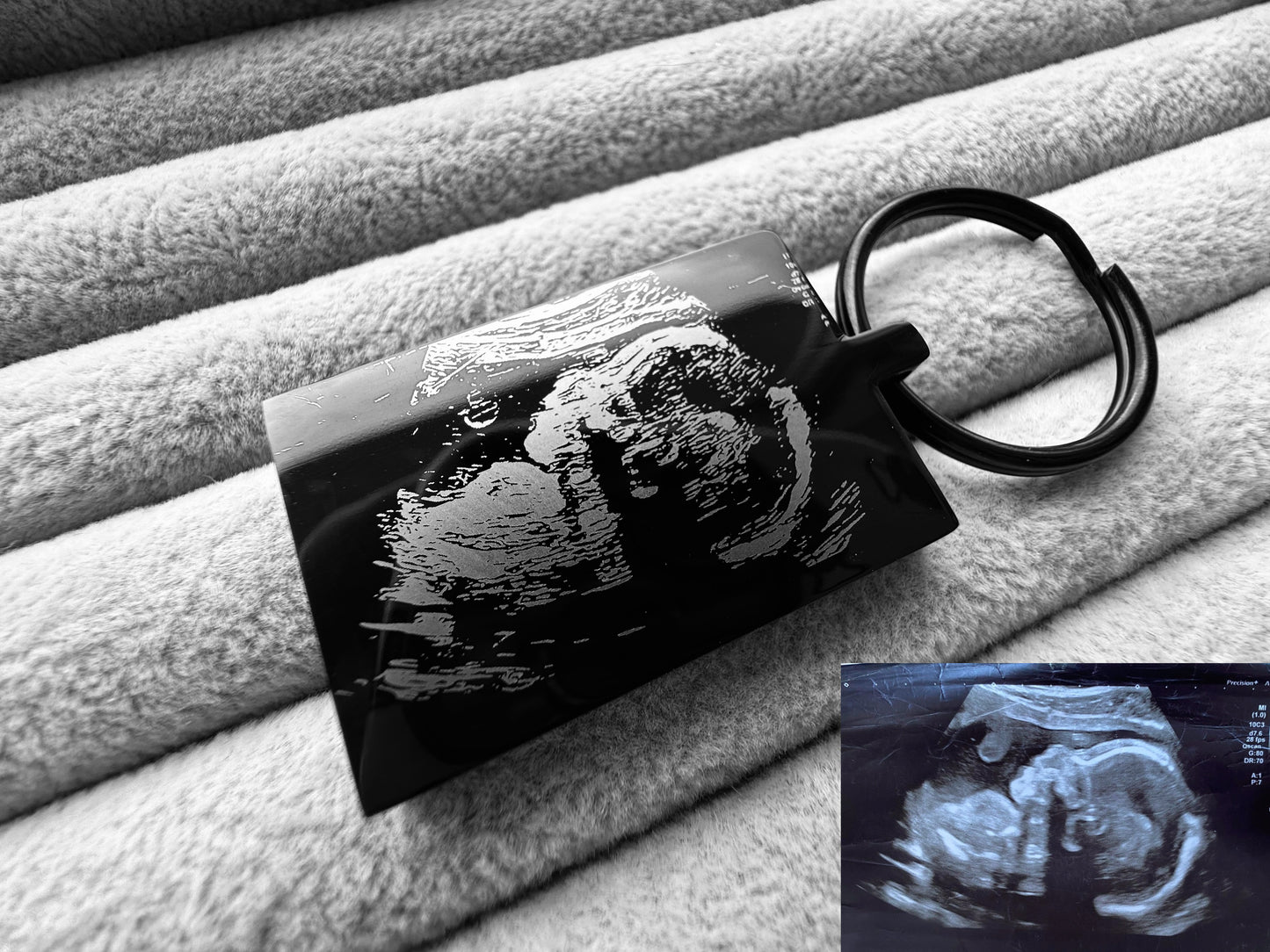 Baby Ultrasound Scan Engraved Rectangular Black Metal Keyrings