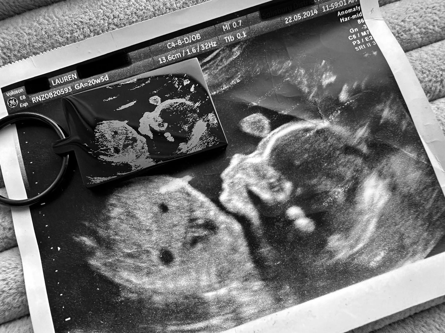 Baby Ultrasound Scan Engraved Rectangular Black Metal Keyrings