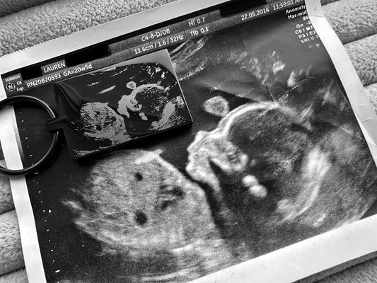 Baby Ultrasound Scan Engraved Rectangular Black Metal Keyrings